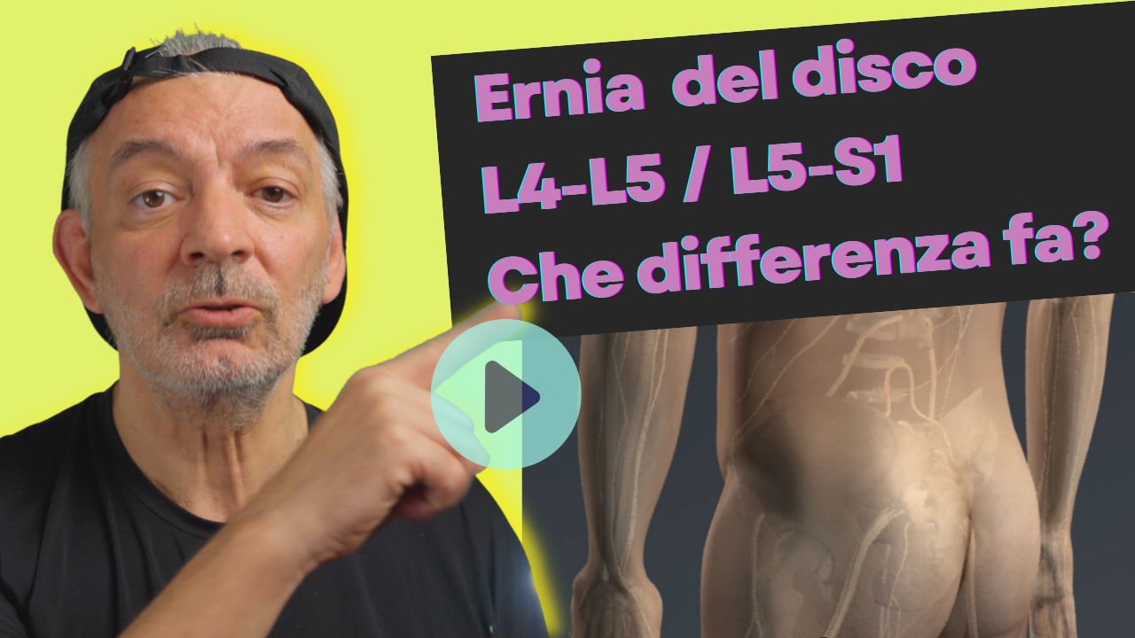 Ernia del disco L4L5 - L5S1 Che differenza fa ?