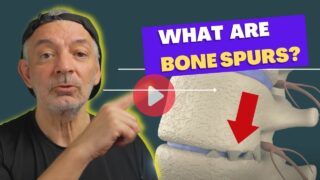 short Video Clip What are Bone spurs?